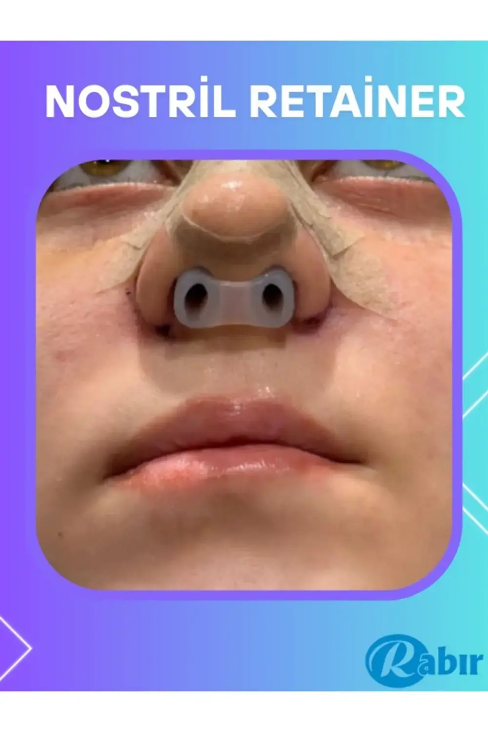 Nostril Retainer No 7 Burun Deliği Şekillendirici