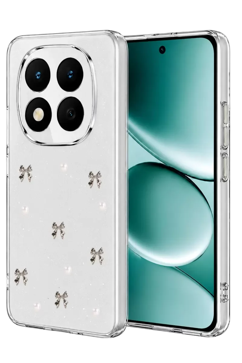 Note 15 Pro 5G ile Uyumlu Fiyonk Desenli Kapak - Desen 8 | Darbe Korumalı Şeffaf Telefon Kılıfı