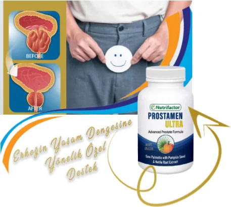 Nutrifactor Prostamen 2 Adet – Erkek Yaşam Dengesi İçin Özel Destek Fiyatı, Yorumları ve Özellikleri