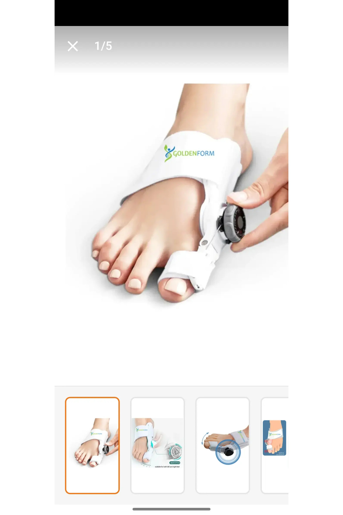 ortez-Ayarlı Ayak Baş Parmak Kemik Düz. Başparmak Eğriliği Düzelt