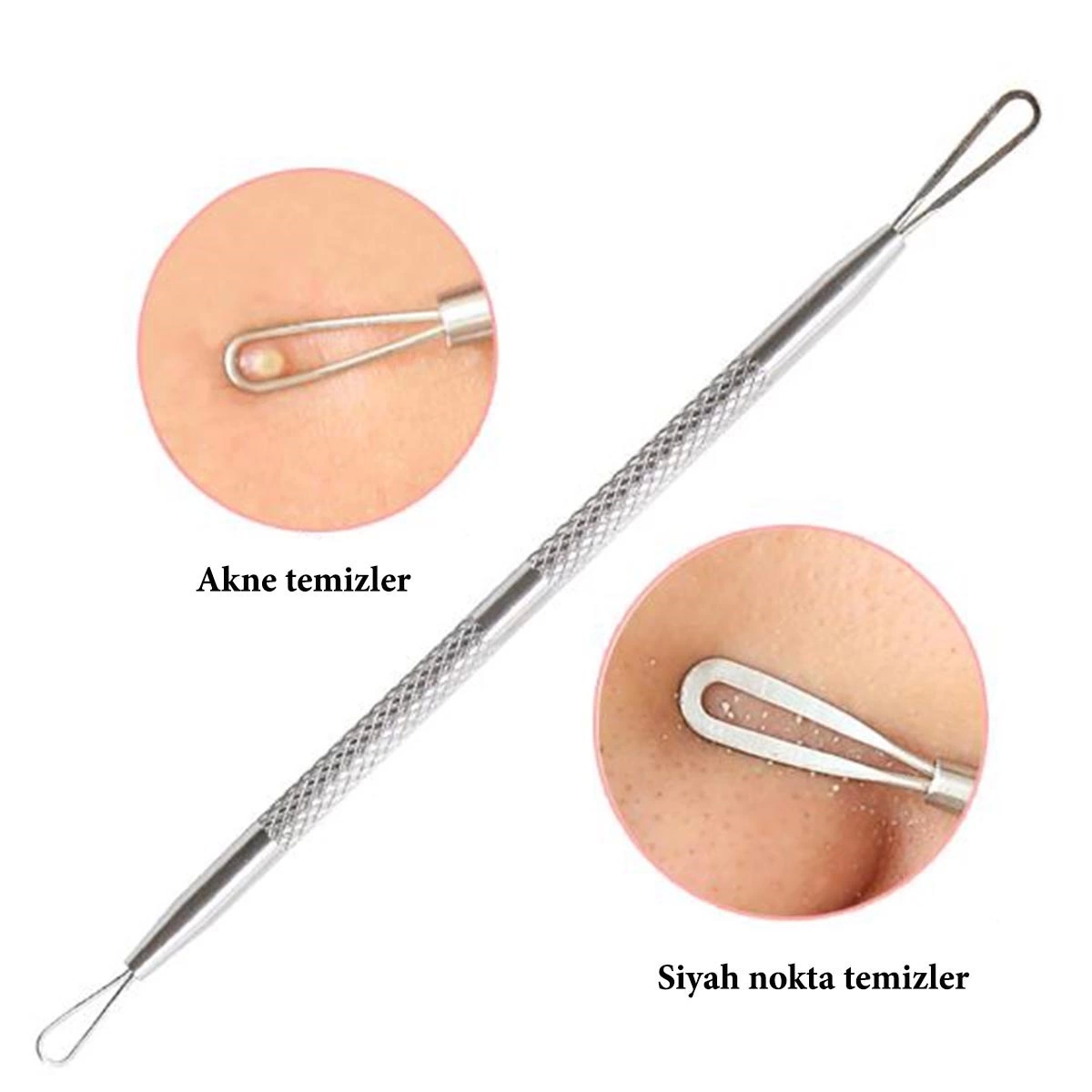 Paslanmaz Çelik Siyah Nokta Sivilce Ve Akne Temizleyici Set 3'lü