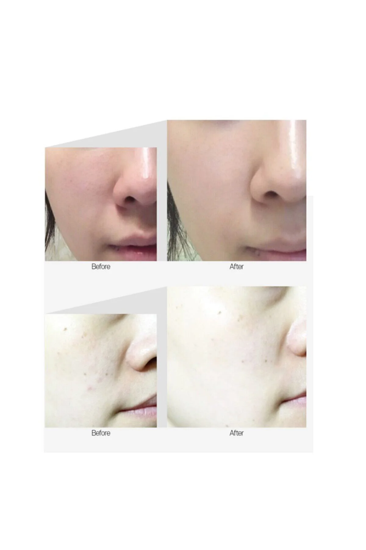Peptide-tox Bor Ampoule 30 ml Kırışıklıkl karşıtı . Etkili Yüz Se