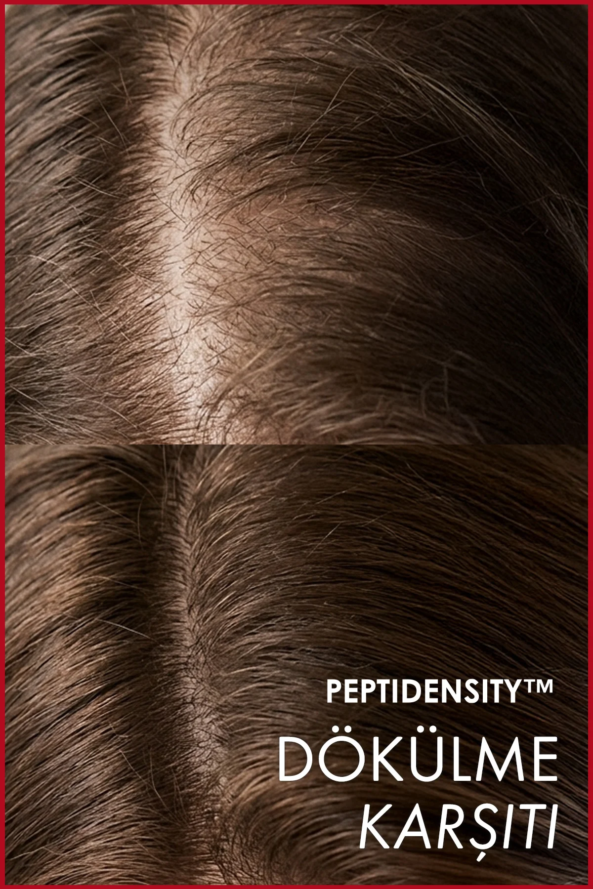 PeptiDensity™ Dökülme Karşıtı Peptit Saç Serumu | Saç Yoğunlaştır Fiyatı, Yorumları ve Özellikleri