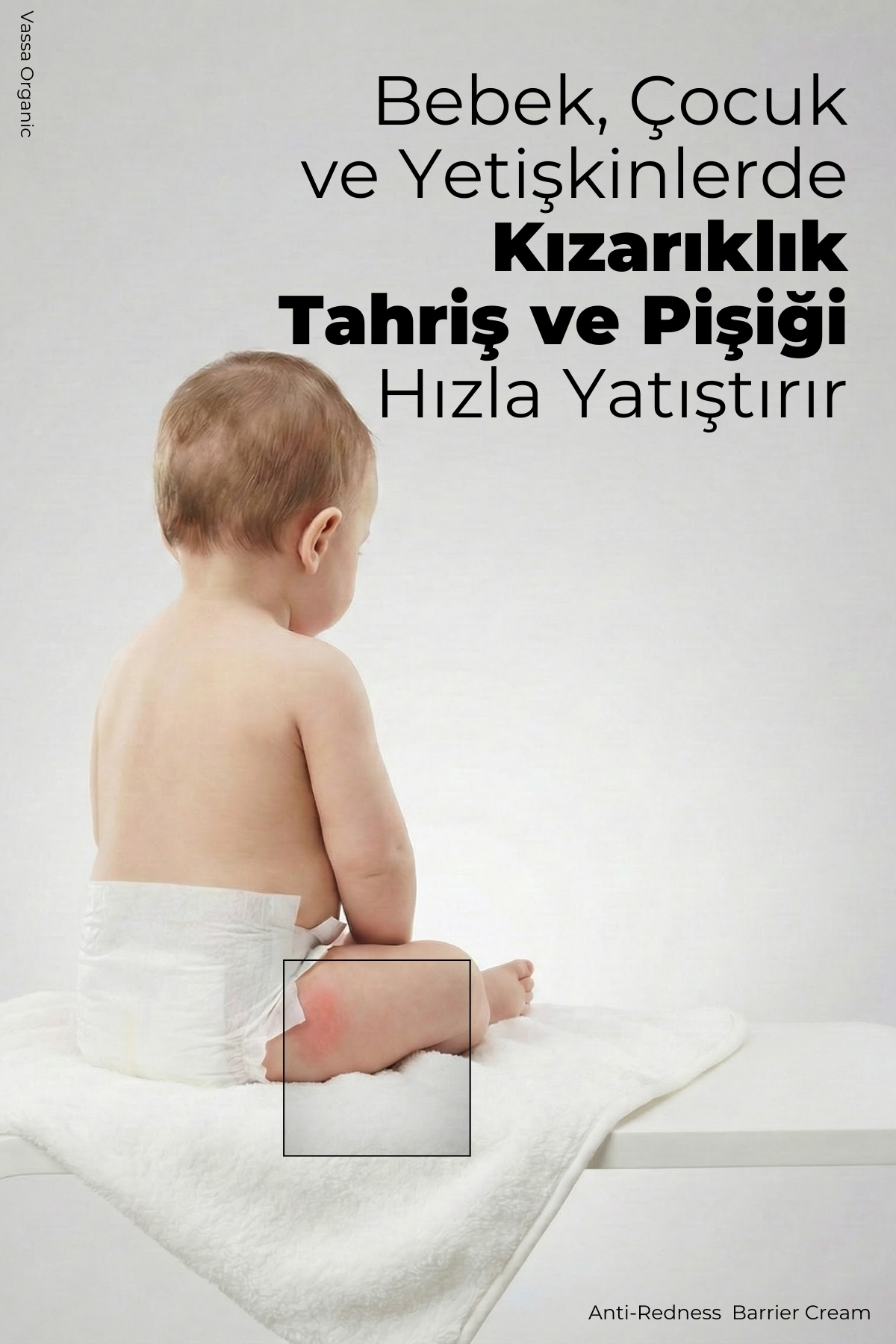 Pişik, Kızarıklık ve Tahriş Karşıtı Yatıştırıcı Onarıcı Bakım Kremi – Pişik Önleyici Krem 100 ml