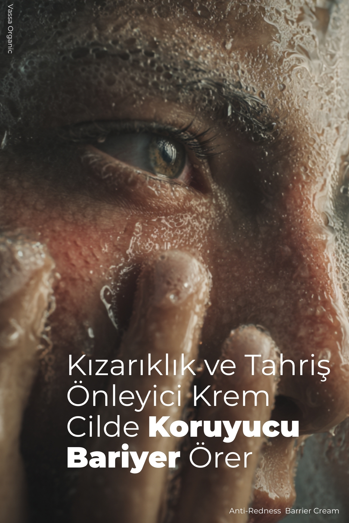 Pişik, Kızarıklık ve Tahriş Karşıtı Yatıştırıcı Onarıcı Bakım Kremi – Pişik Önleyici Krem 100 ml