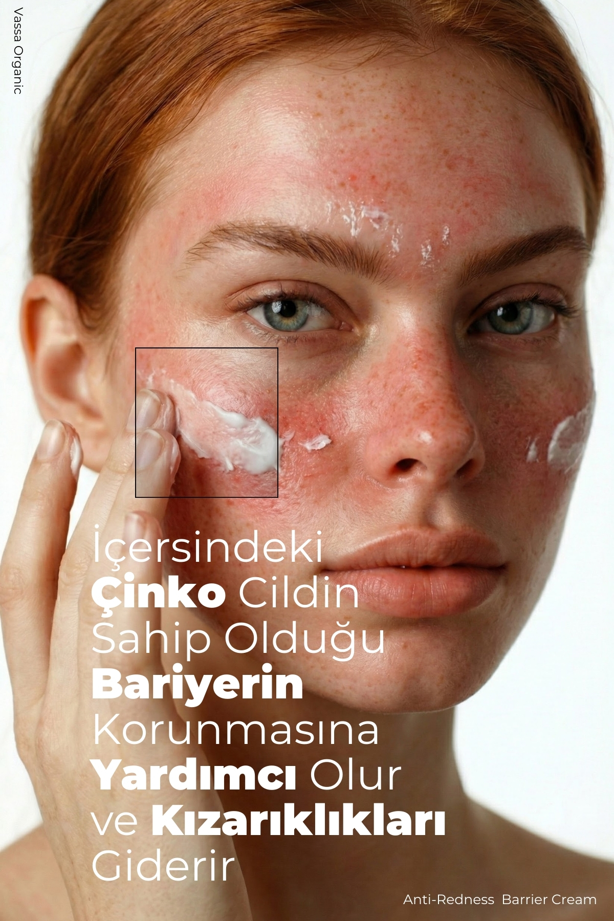 Pişik, Kızarıklık ve Tahriş Karşıtı Yatıştırıcı Onarıcı Bakım Kremi – Pişik Önleyici Krem 100 ml