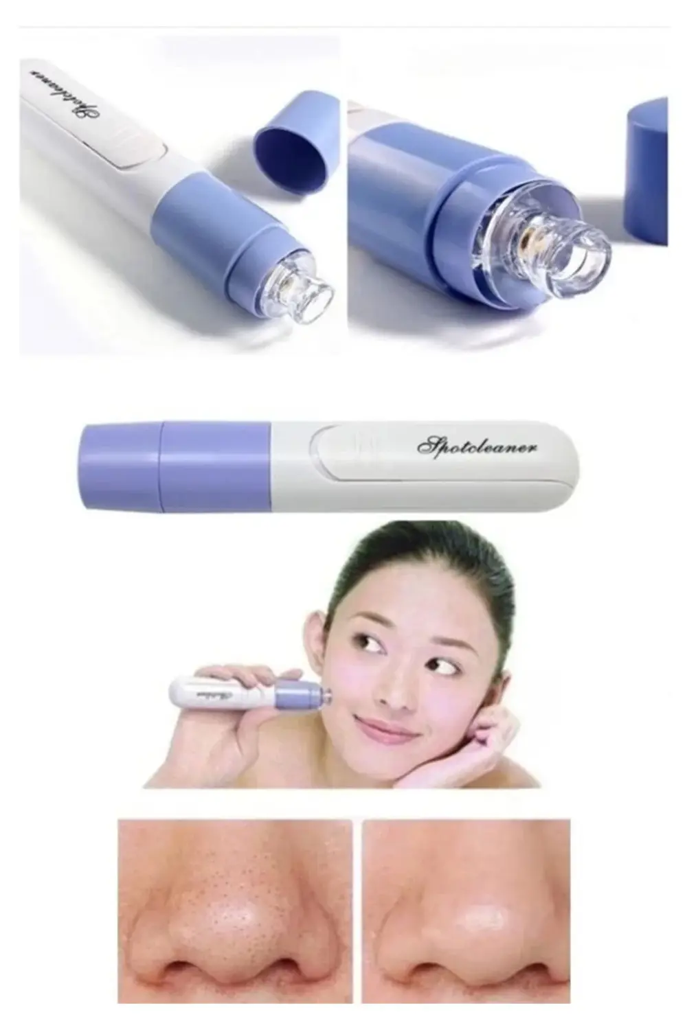 Pore Cleaner Vakumlu Yüz Temizleme Siyah Nokta Temizleme Cihazı