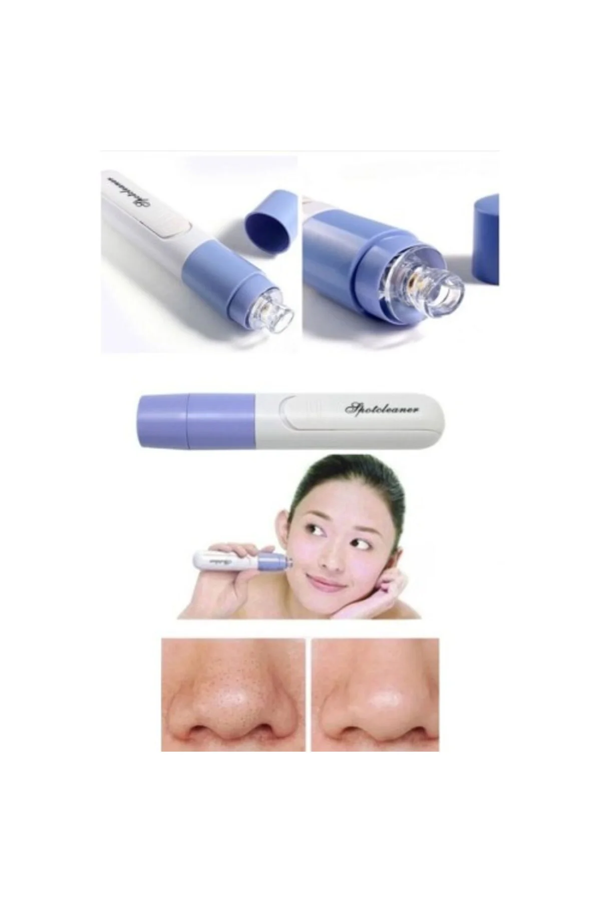 Pore Cleaner Vakumlu Yüz Temizleme Siyah Nokta Temizleme Cihazı