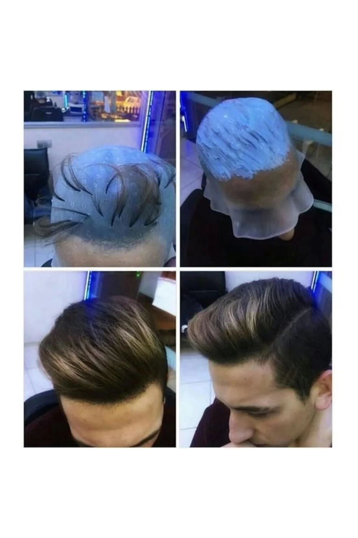 Profesyonel Silikon Delikli Röfle Bonesi ( Lisinya )