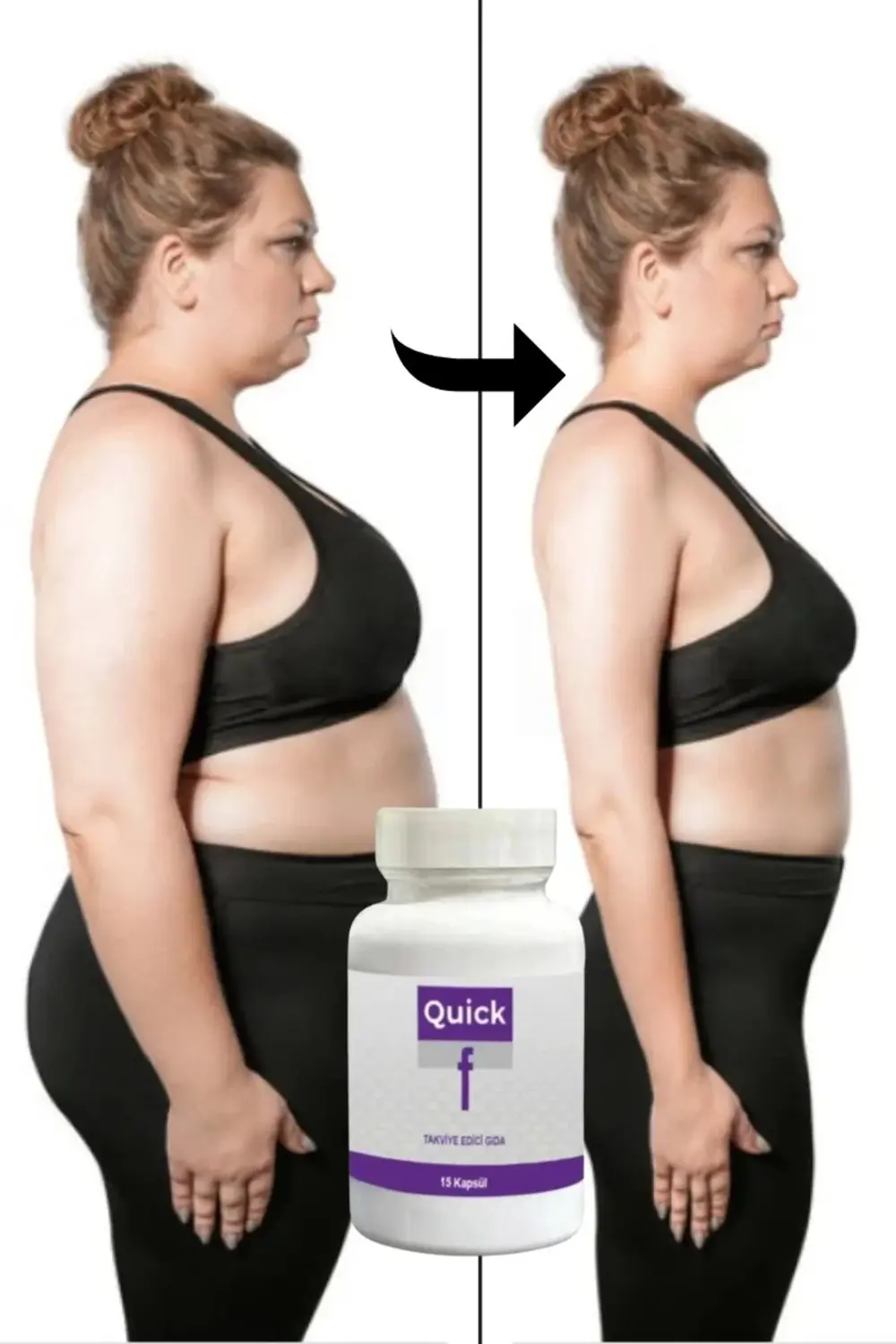 Quick F Destekleyici Ürün 15'li 1 Adet