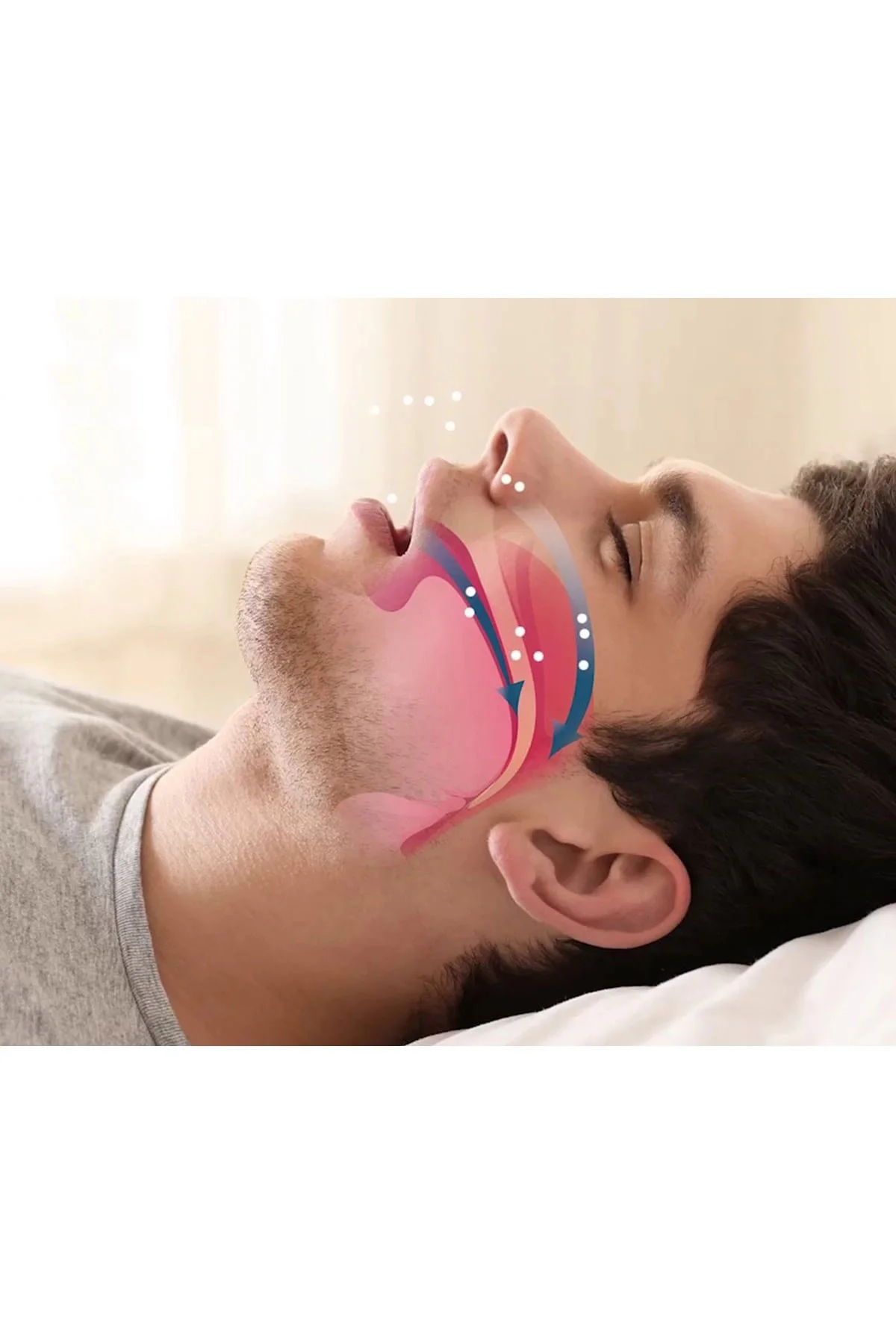 Rahat Uyku İçin Anti Snore Sleep Horlama Engelleyici Aparat Uyku 