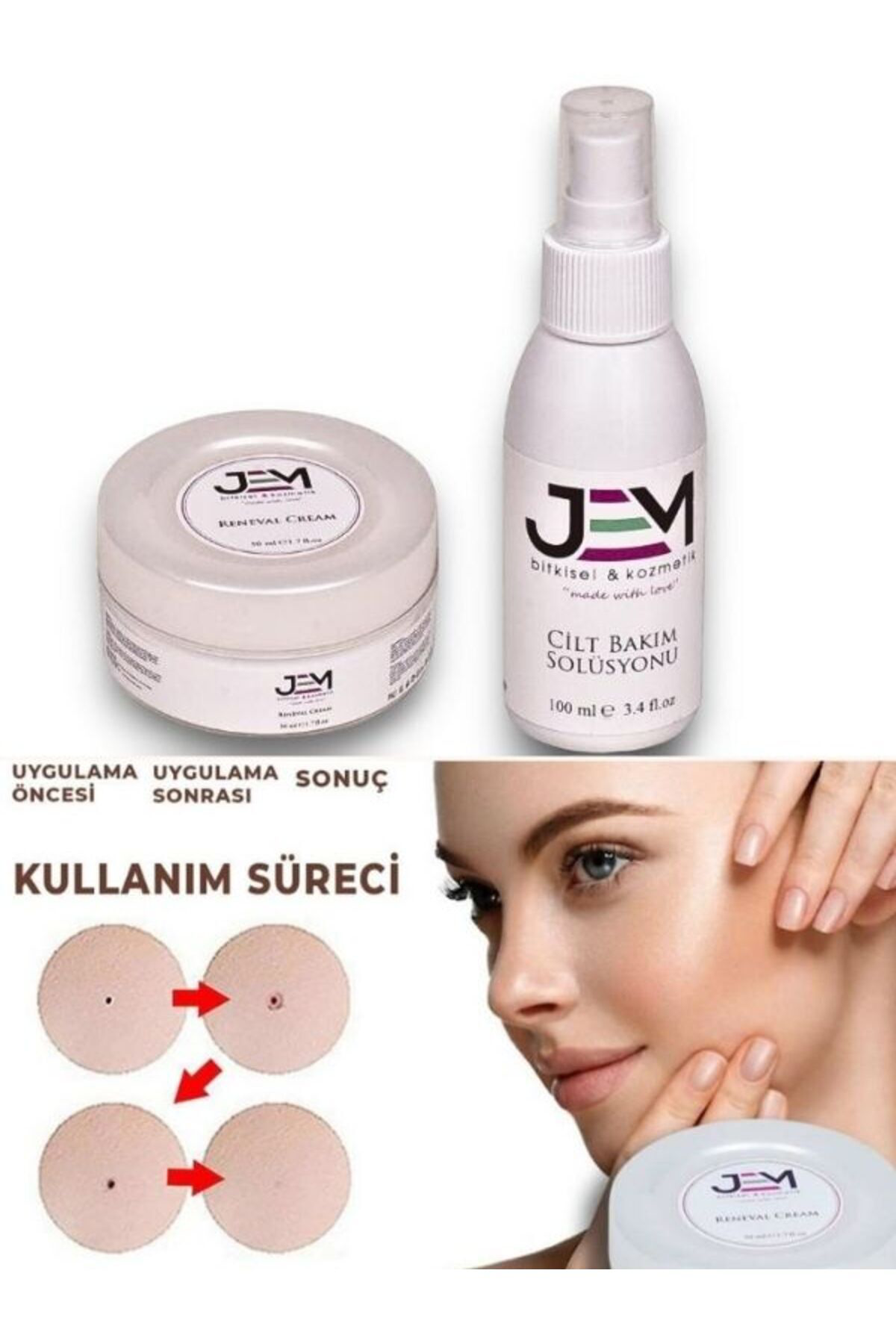 Renewal Cream Wart Set