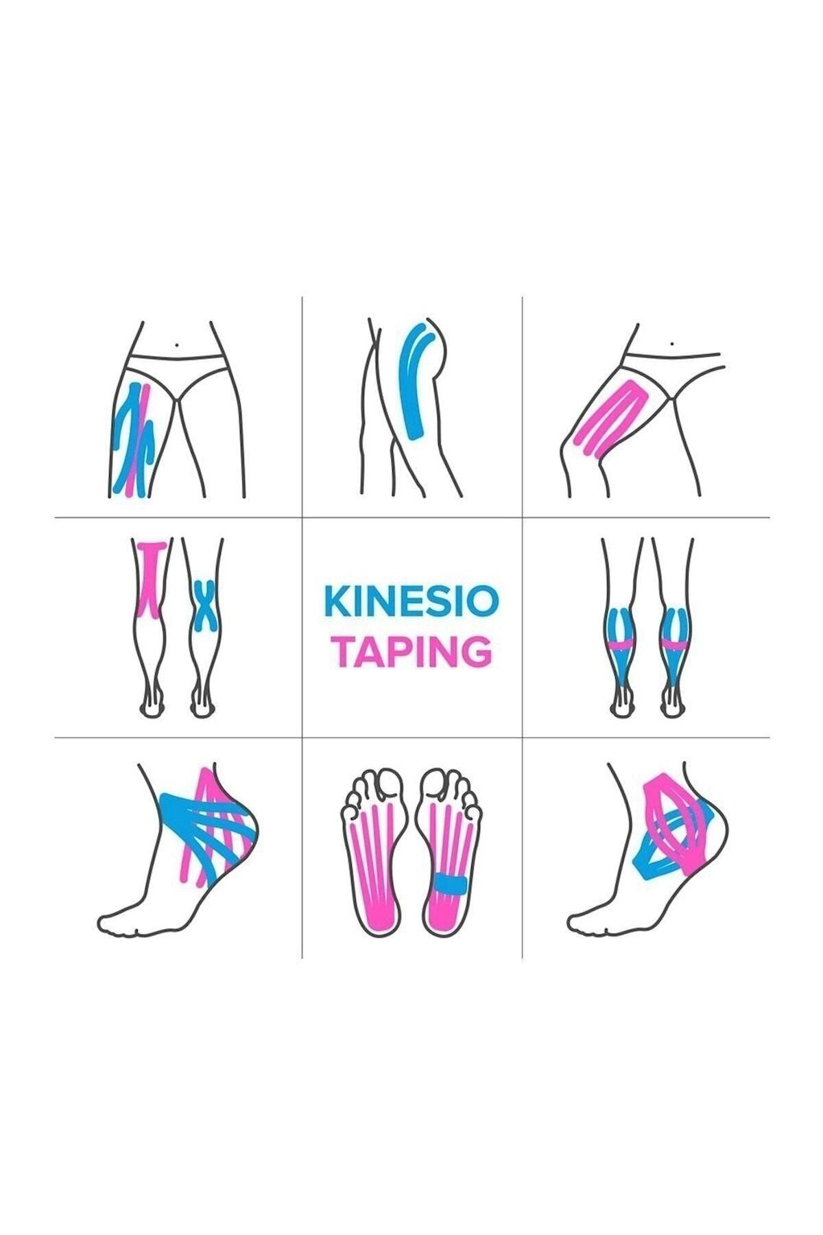 Medwelt Renkli Ağri Bantlari Kinezyo Bandi 5Cmx5m