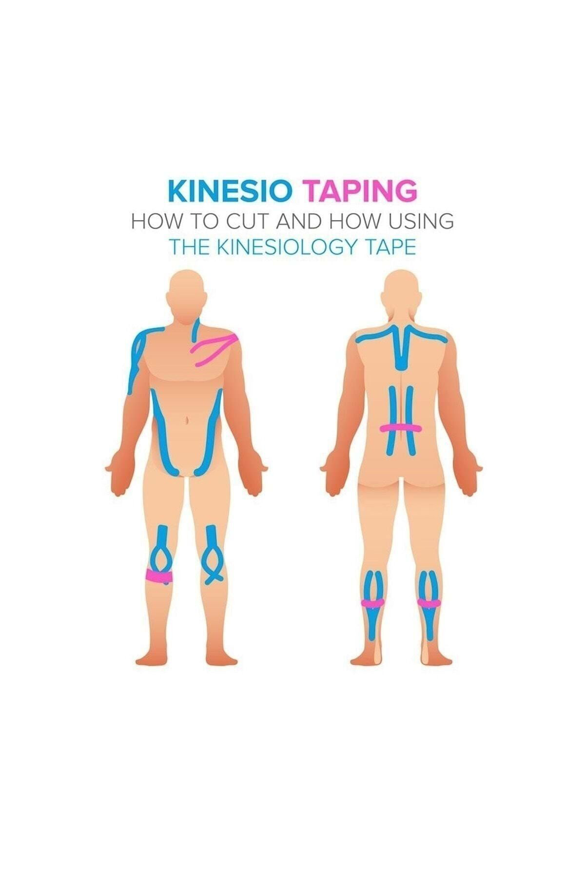 Medwelt Renkli Ağri Bantlari Kinezyo Bandi 5Cmx5m