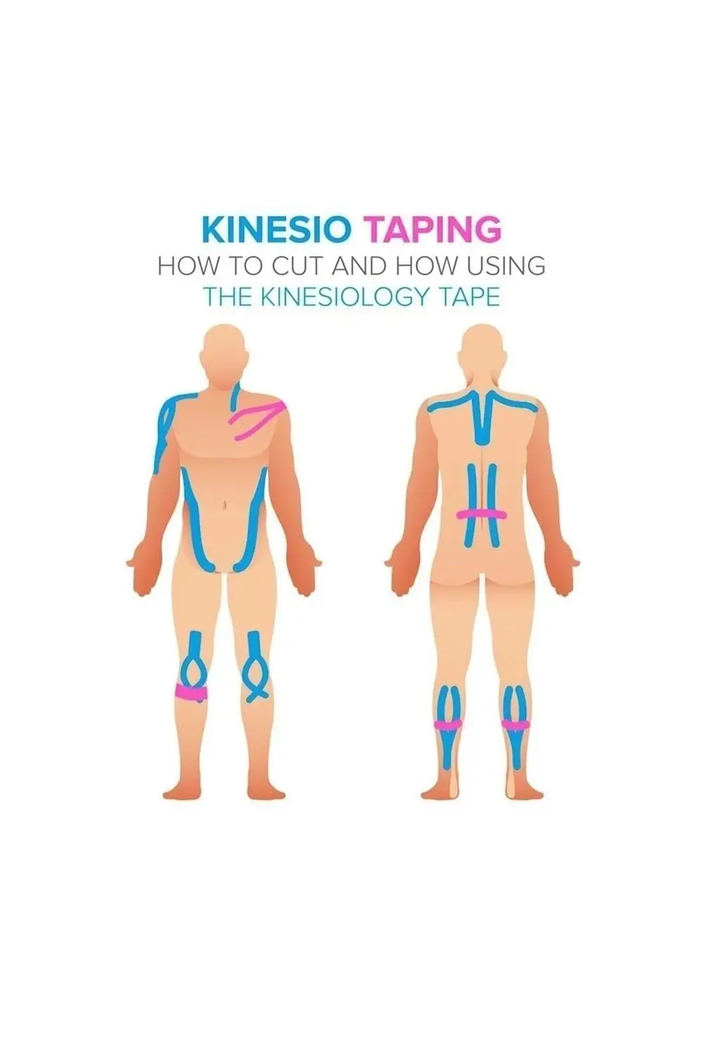 Renkli Ağrı Bantları Kinezyo Bandı 5cmx5m