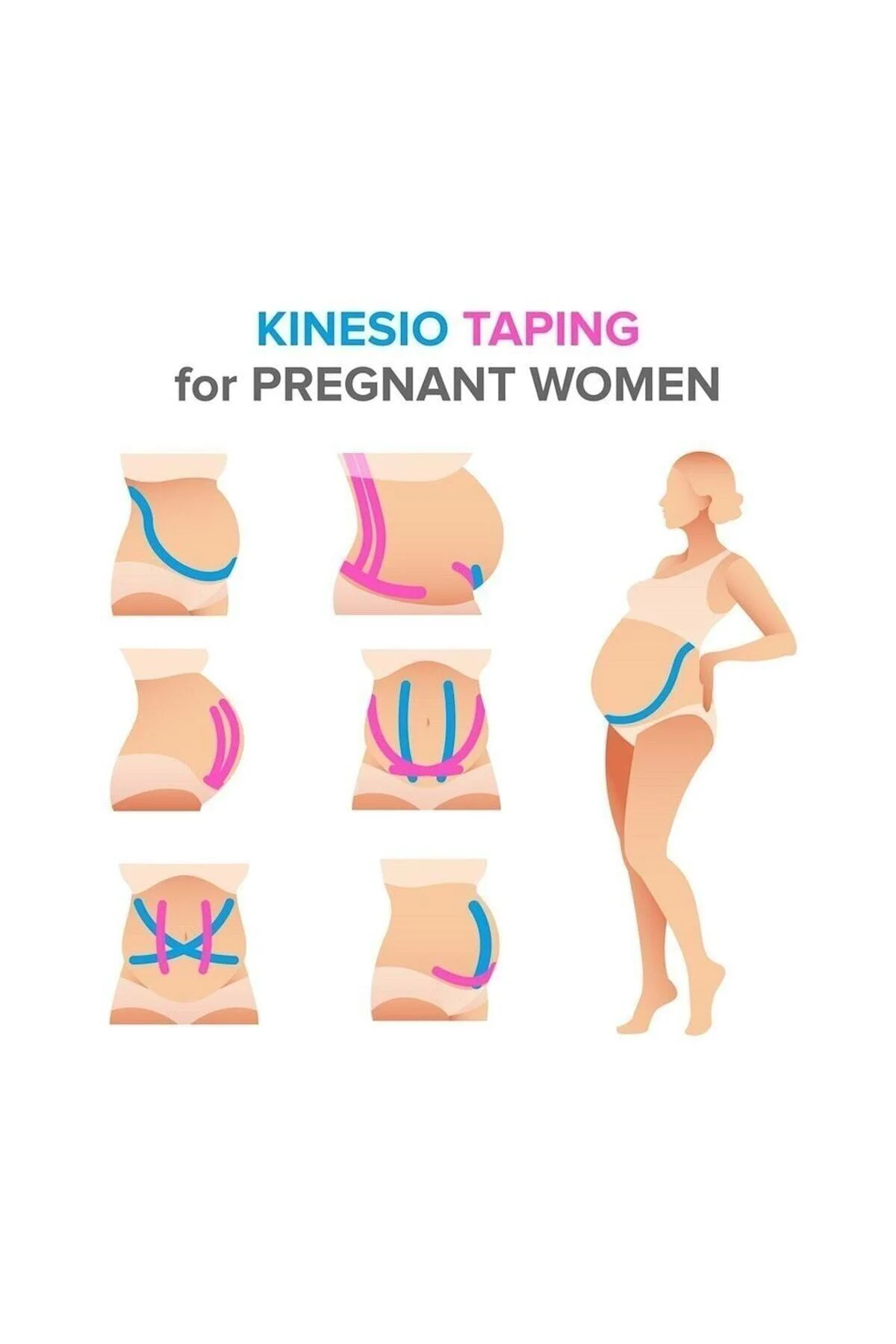 Renkli Ağrı Bantları Kinezyo Bandı 5cmx5m