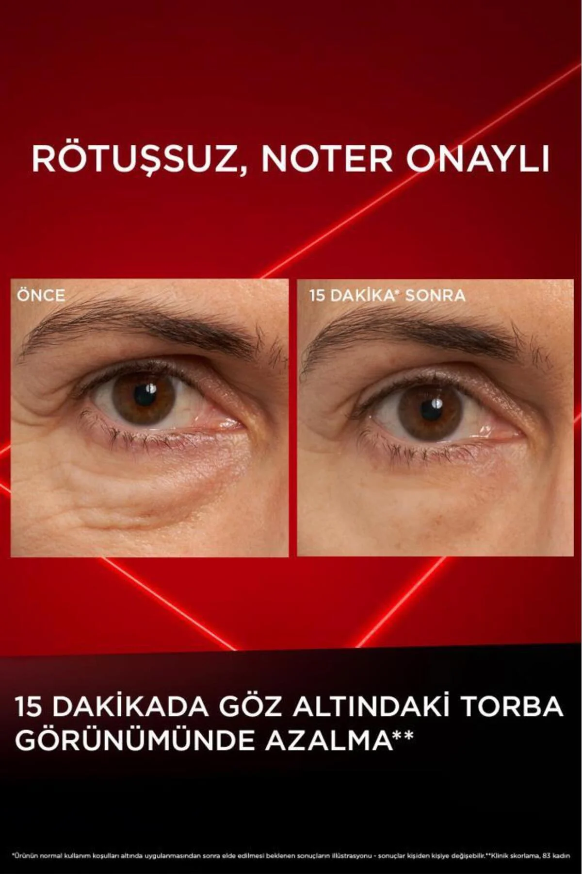Revitalift Lazer Eyebag Instant Eraser Göz Altı Torba Görünümüne Karşı Etkili Göz Kremi 15ml