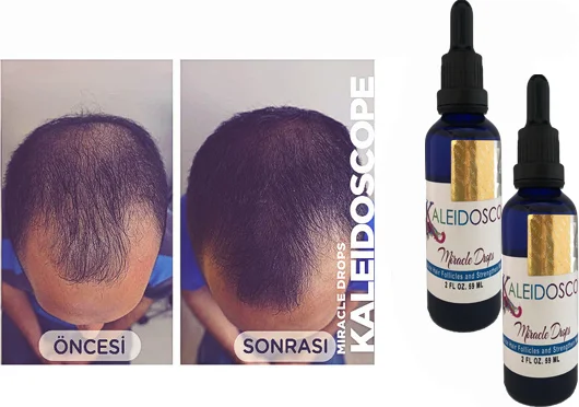Saç Bakım Yağı - Zayıf Saçları Güçlendirici Miracle Drops 2'li Paket Fiyatı, Yorumları ve Özellikleri