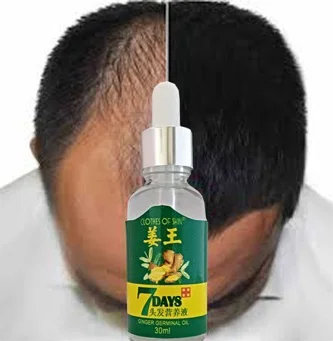 Saç Dökülmesine Karşı Saç Büyütme Serumu - 30ML Ginger Essential Oil Saç Bakım Yağı Fiyatı, Yorumları ve Özellikleri