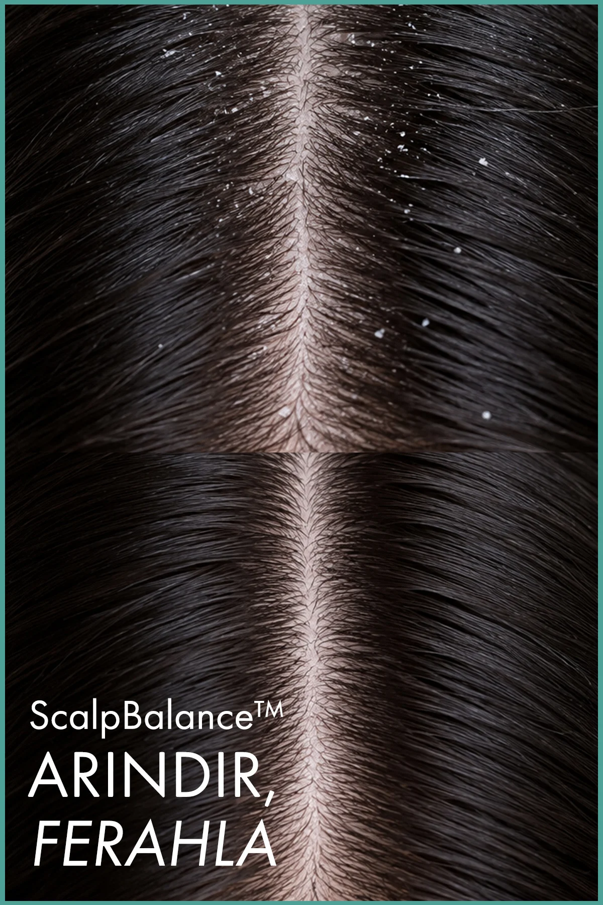 ScalpBalance™ Kepek Karşıtı Arındırıcı Şampuan – Saç Derisi Denge Fiyatı, Yorumları ve Özellikleri