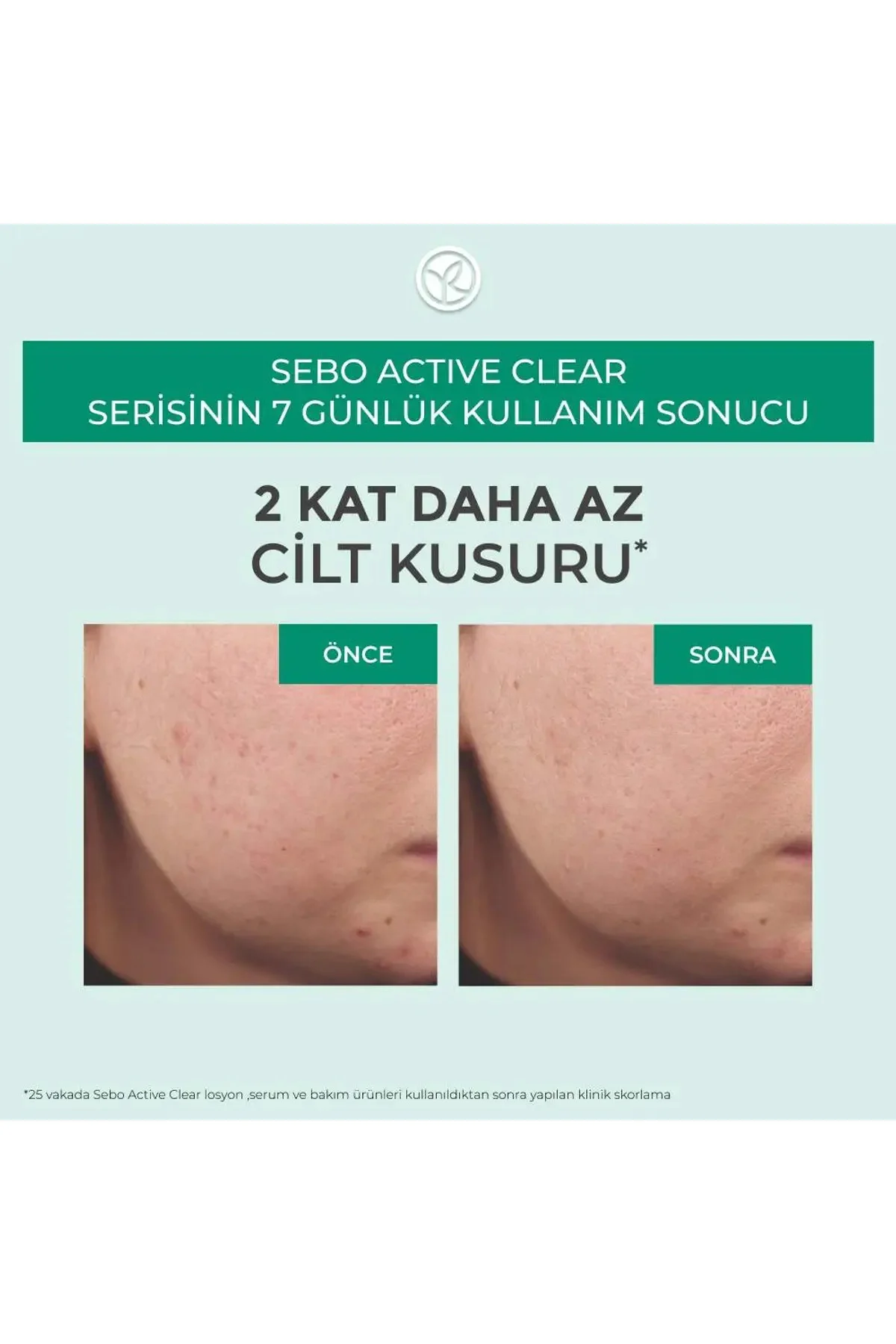 Sebo Pure Vegetal-Salisilik Asit & Sitrik Asit İçerikli Gözenek S