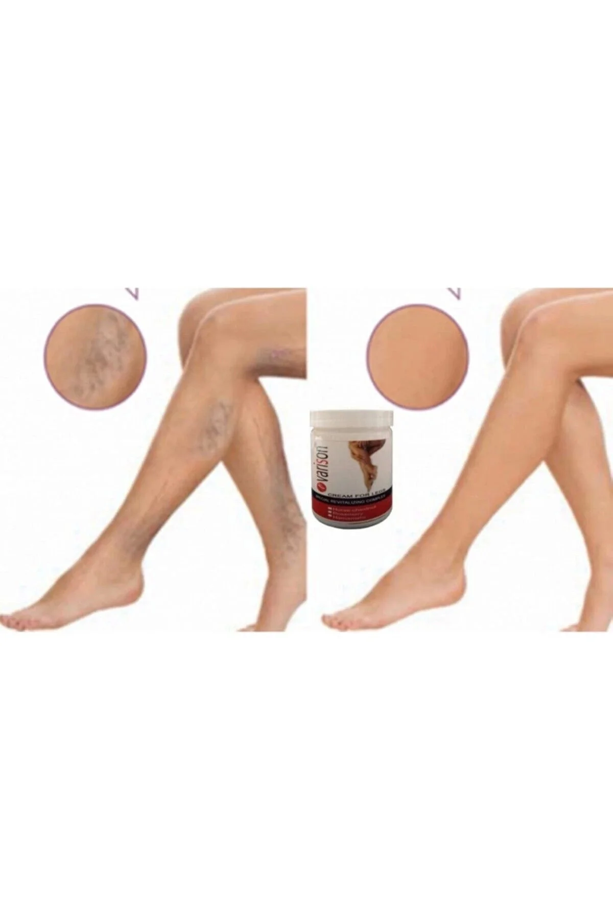 Selüllit Karşıtı Bacak Kremi 200 ml × 2 Adet – Pürüzsüz ve Sertleşmiş Ten İçin Etkili Bakım