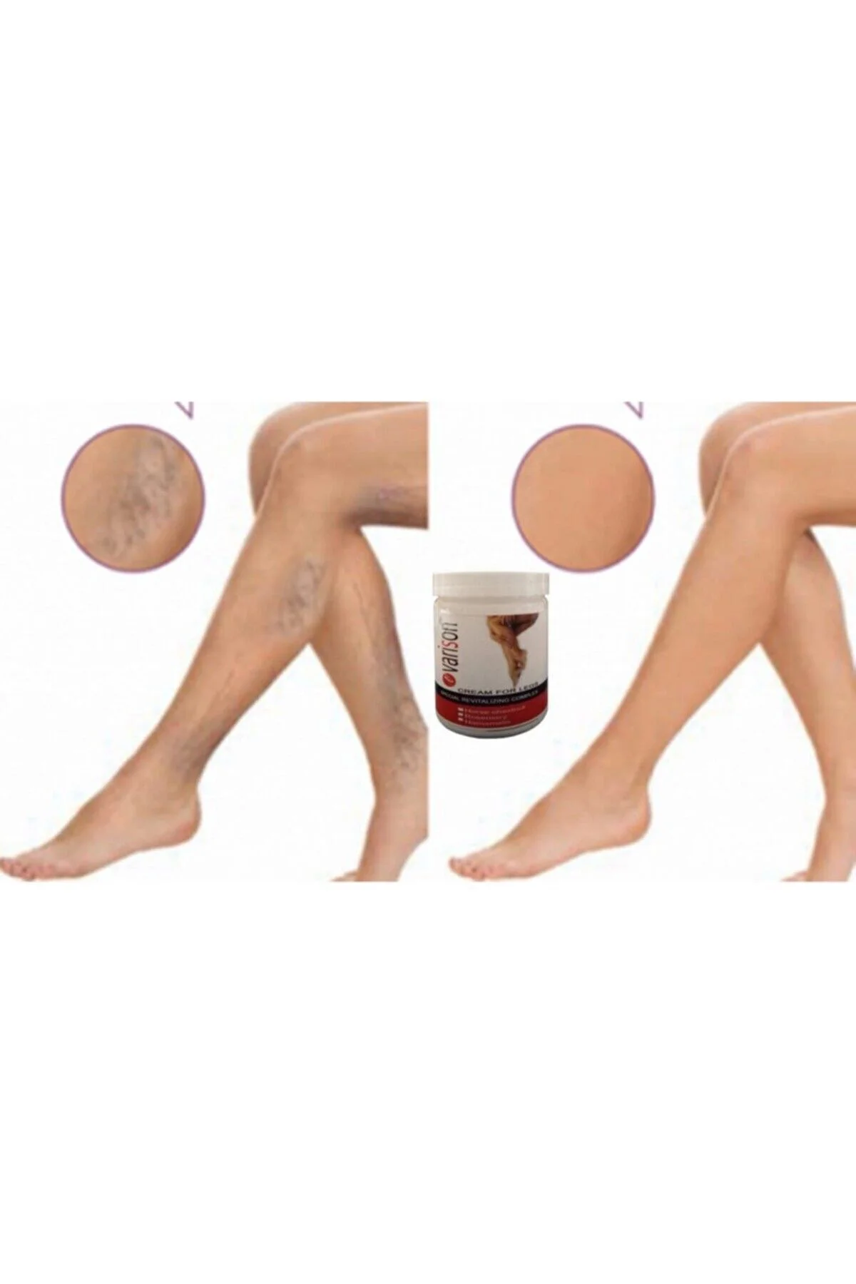 Selüllit Karşıtı Bacak Kremi 200 ml × 2 Adet – Pürüzsüz ve Sertleşmiş Ten İçin Etkili Bakım