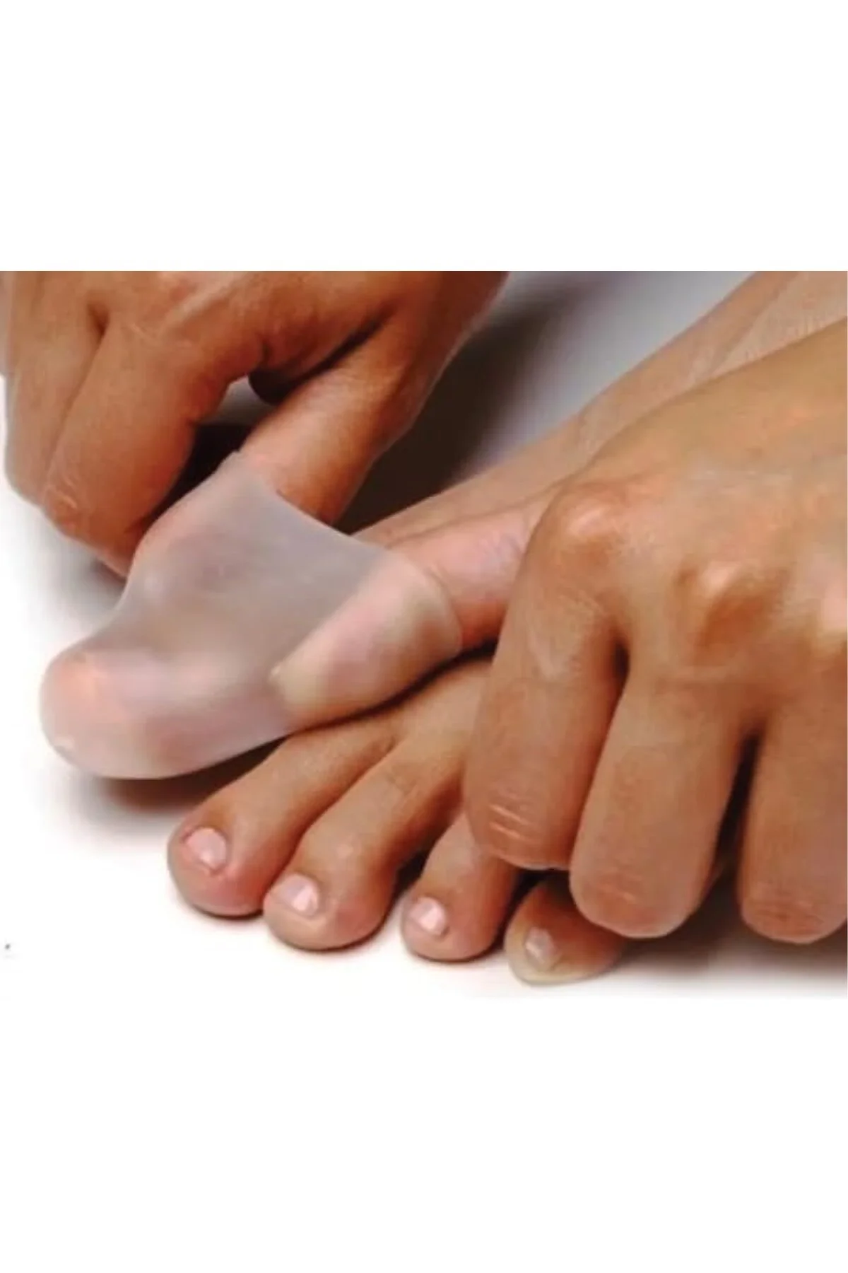 Silikon Başparmak Tırnak Batık Koruyucu Jel Gömlek (1 Çift)