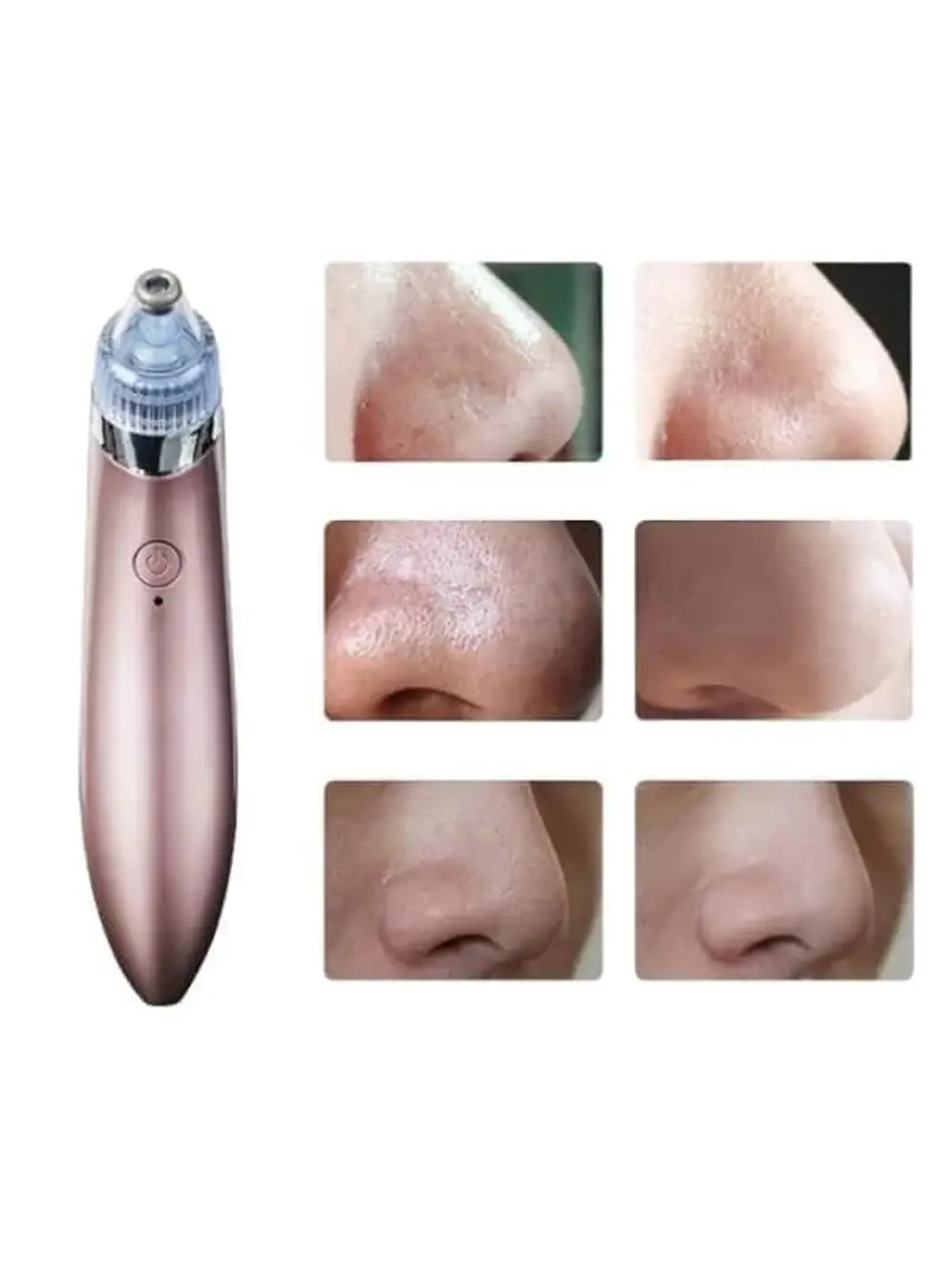 SİYAH NOKTA CİHAZI