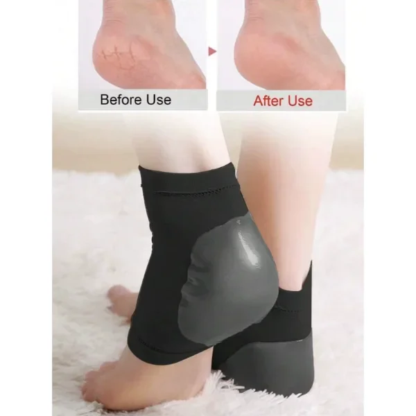 Siyah Silikon Topuk Nemlendirici Çorap ile Derinlemesine Ayak Bak