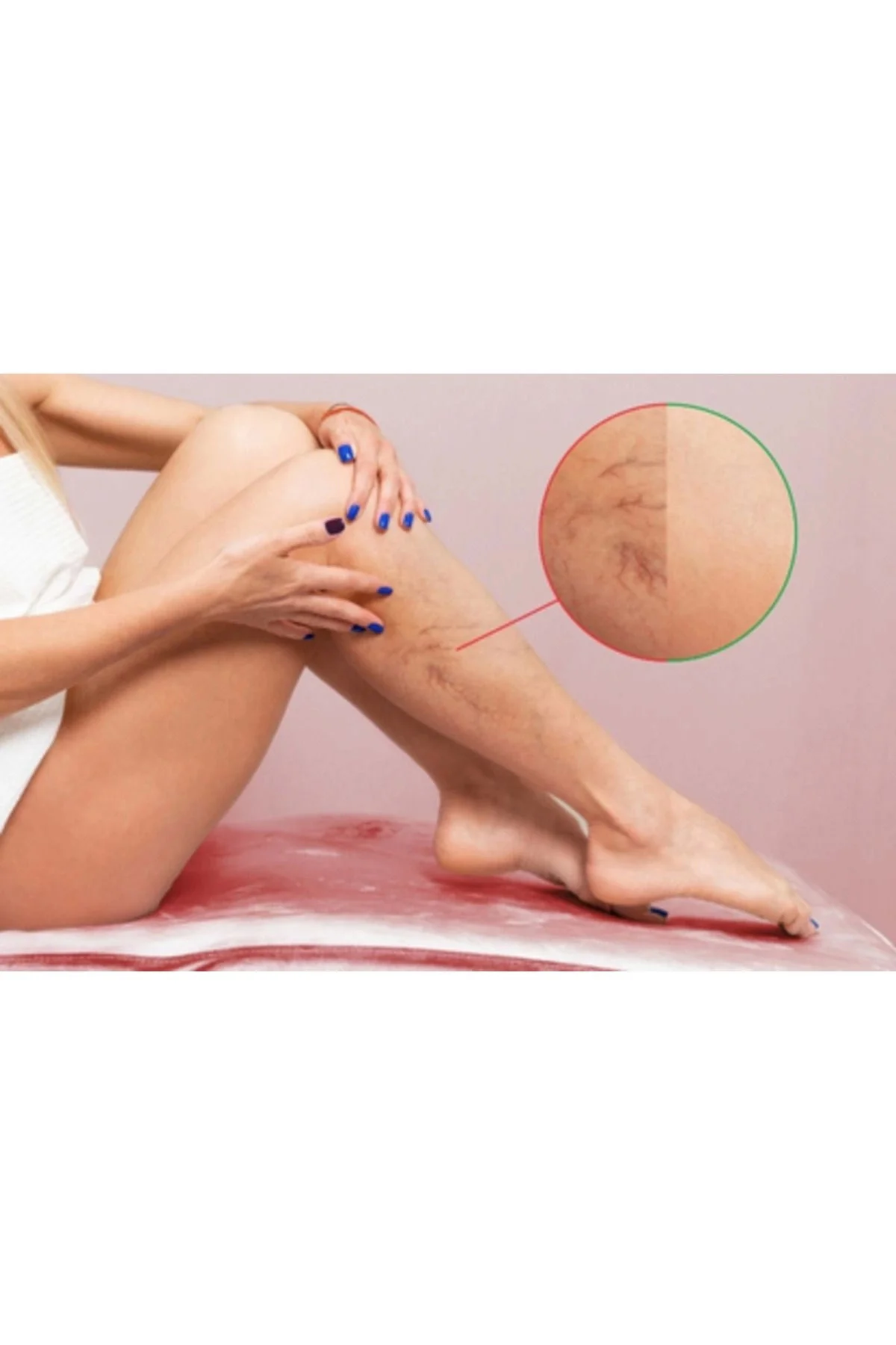 Spider Veins Defense Cream Selülit ve Bacak Bakım Kremi 120ml x 2 Adet Fiyatı, Yorumları ve Özellikleri