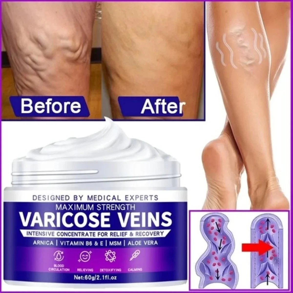 Süper Maximum Strength Varcse Vnis Krem 100 ml – Damar ve Ven Destekli Bakım
