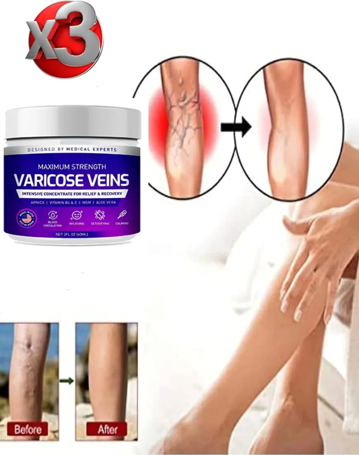 Süper Maximum Strength Varcse Vnis Bakım Kremi 100 ml x 3 Adet – Cilt Bakımında Güçlü Etki