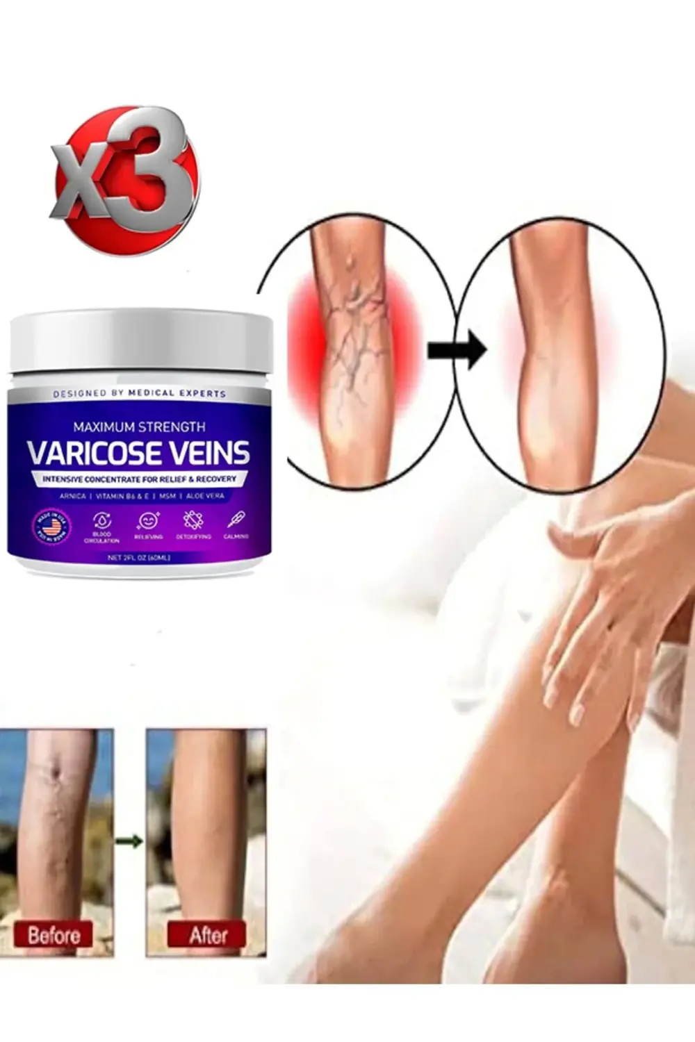 Süper Maximum Strength Varicose Veins Bakım Kremi 100 ml x 3 adet