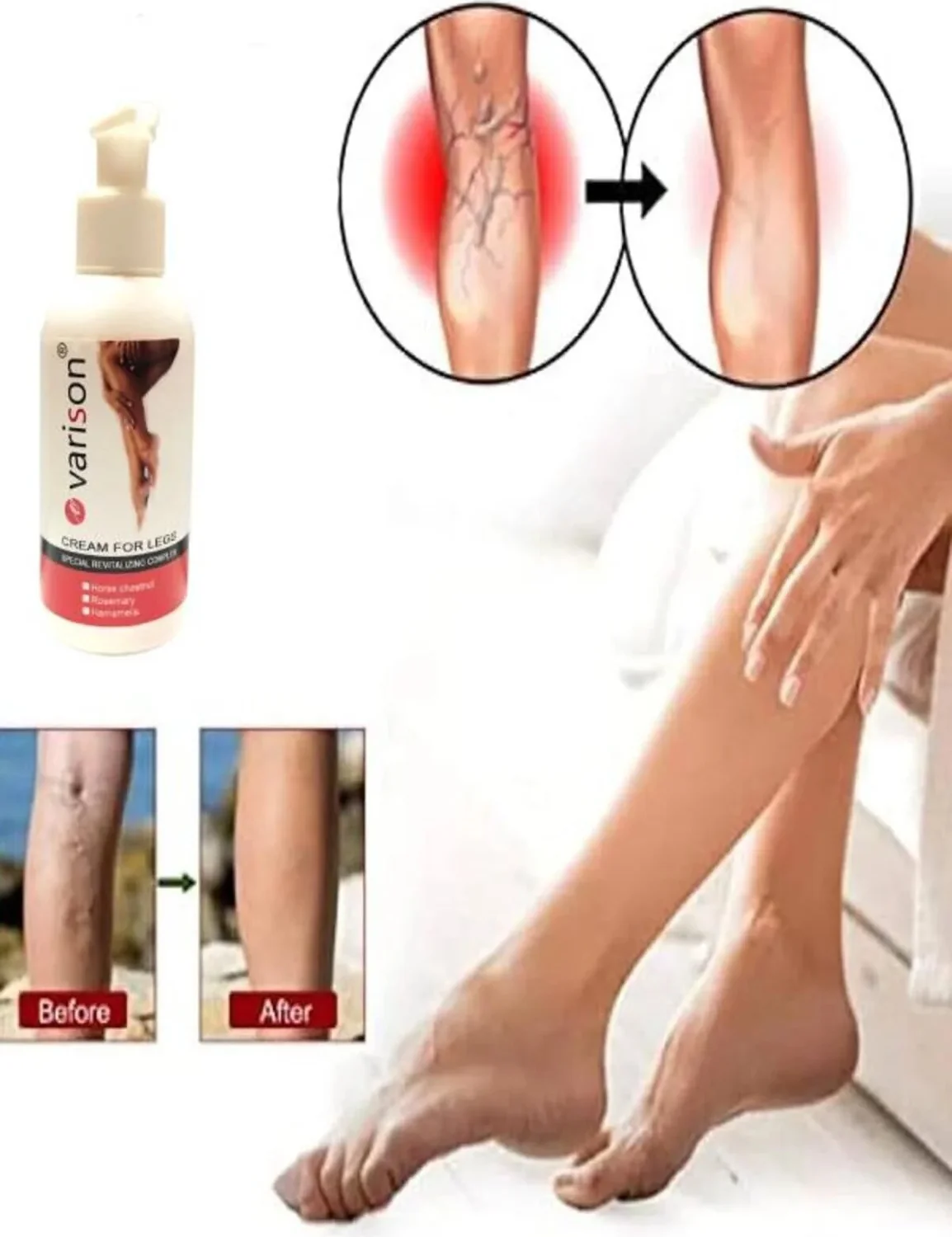 Süper On Sellülit Bacak Bakım Kremi 120 ml - Sellülit Karşıtı Bakım