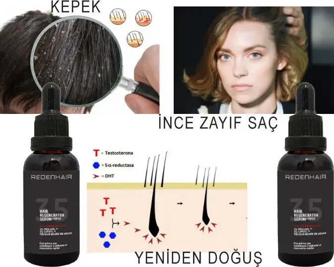 Süper Redenhair Saç Dökülmesine Karşı Güçlü Bakım Serumu 30 ml x 2 Adet Fiyatı, Yorumları ve Özellikleri