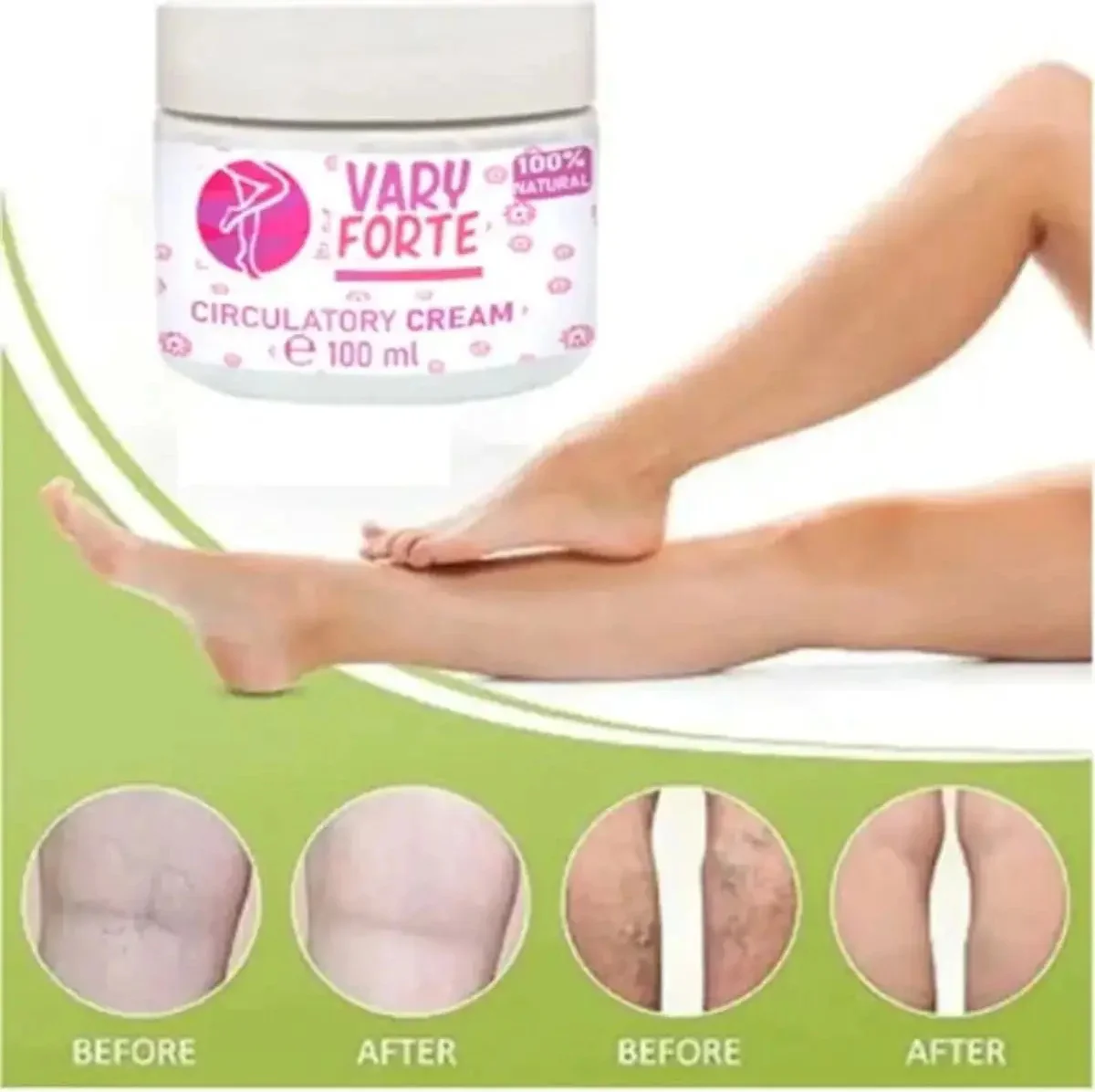 Süper Vary Forte Kavanoz Karşı Krem 100 ml – Sızdırmazlık ve Kolay Kapanma