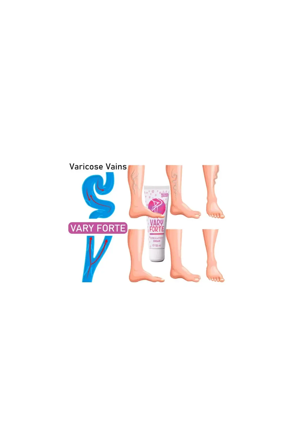Süper Vary Forte Tüp Krem 100 ml Yoğun Varislerinize Güçlü Tesirl Süper Vary Forte Tüp Krem 100 ml Yoğun Varislerinize Güçlü Tesirl