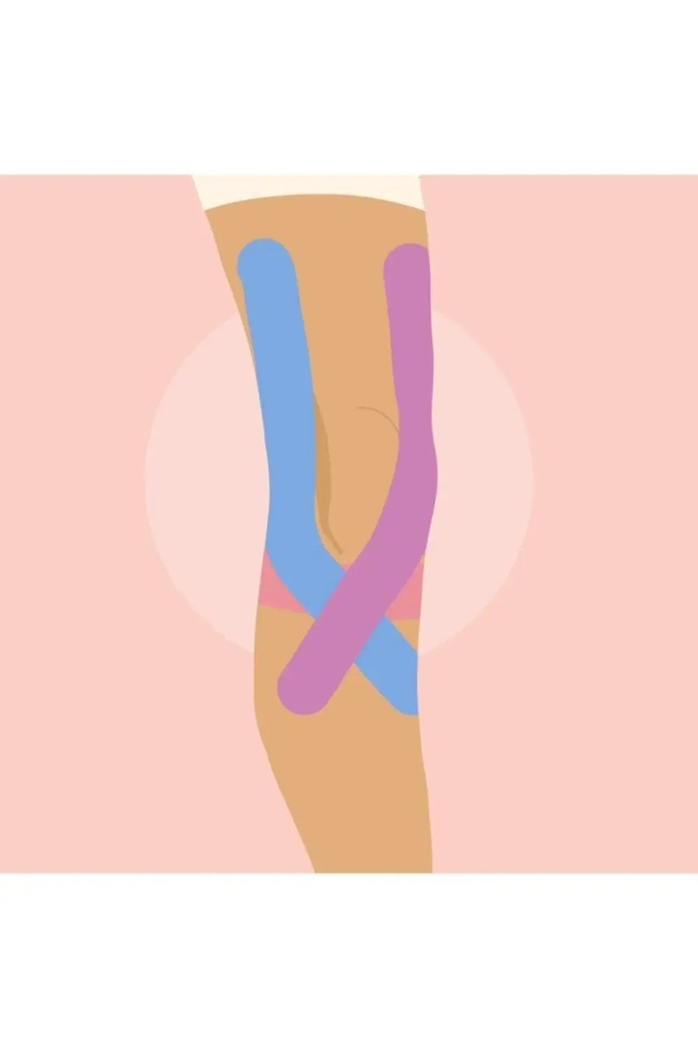 Tape Kinesio Ağrı Bandı 5 Metre X 5 Cm Siyah