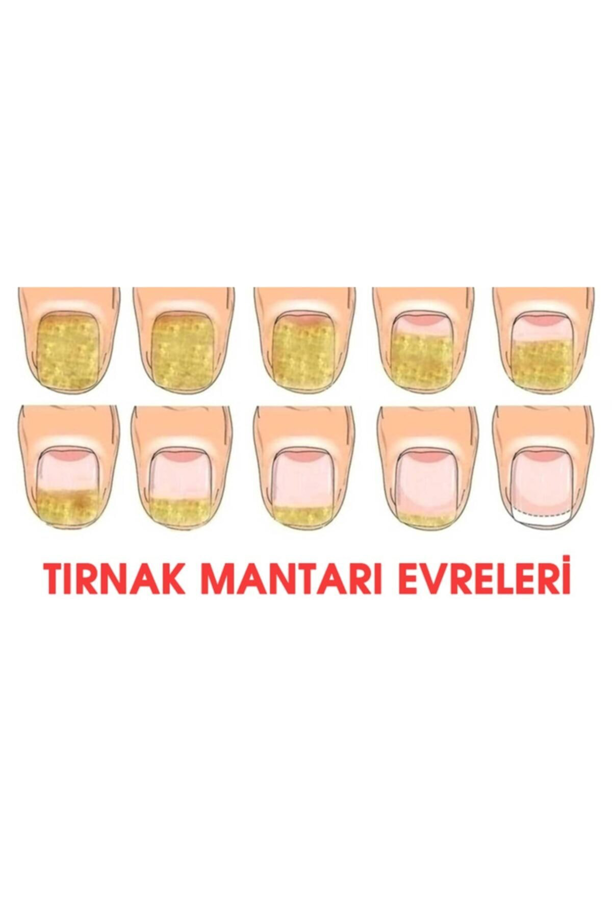 Tırnak Bakım ve Ayak Kremi -Tırnak Mantarı Önleyici Losyon Damla