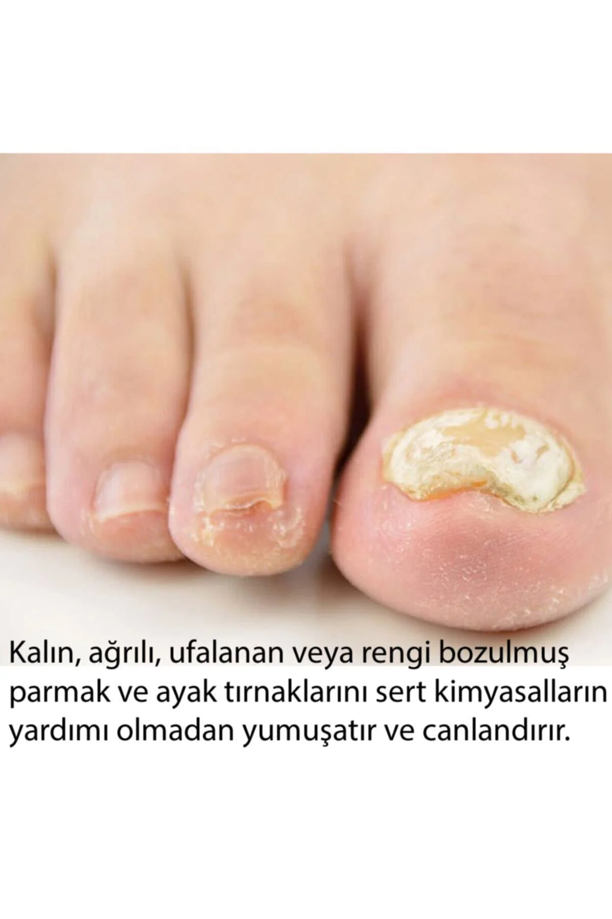 Tırnak Bakım ve Ayak Kremi -Tırnak Mantarı Önleyici Losyon Damla - Görsel 6
