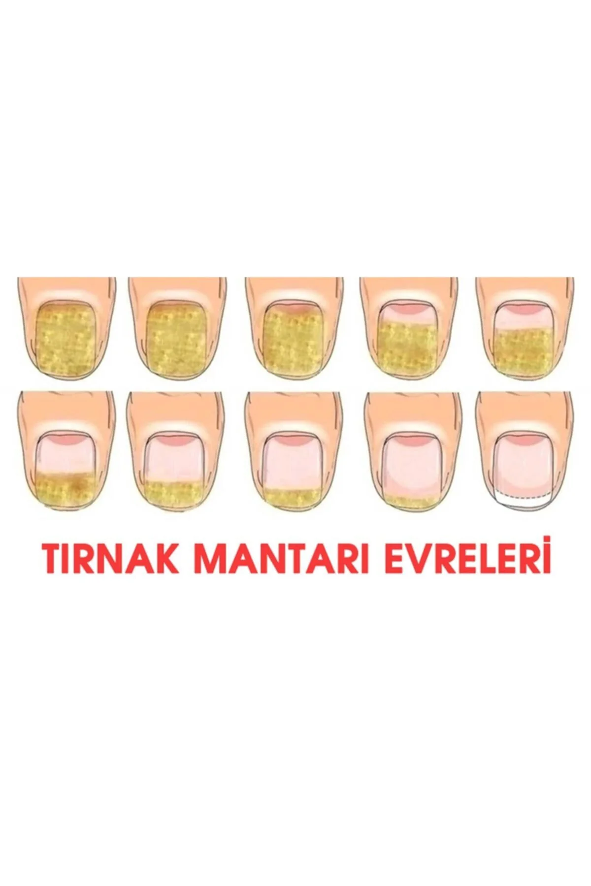Tırnak Bakım ve Ayak Kremi -Tırnak Mantarı Önleyici Losyon Damla - Görsel 8