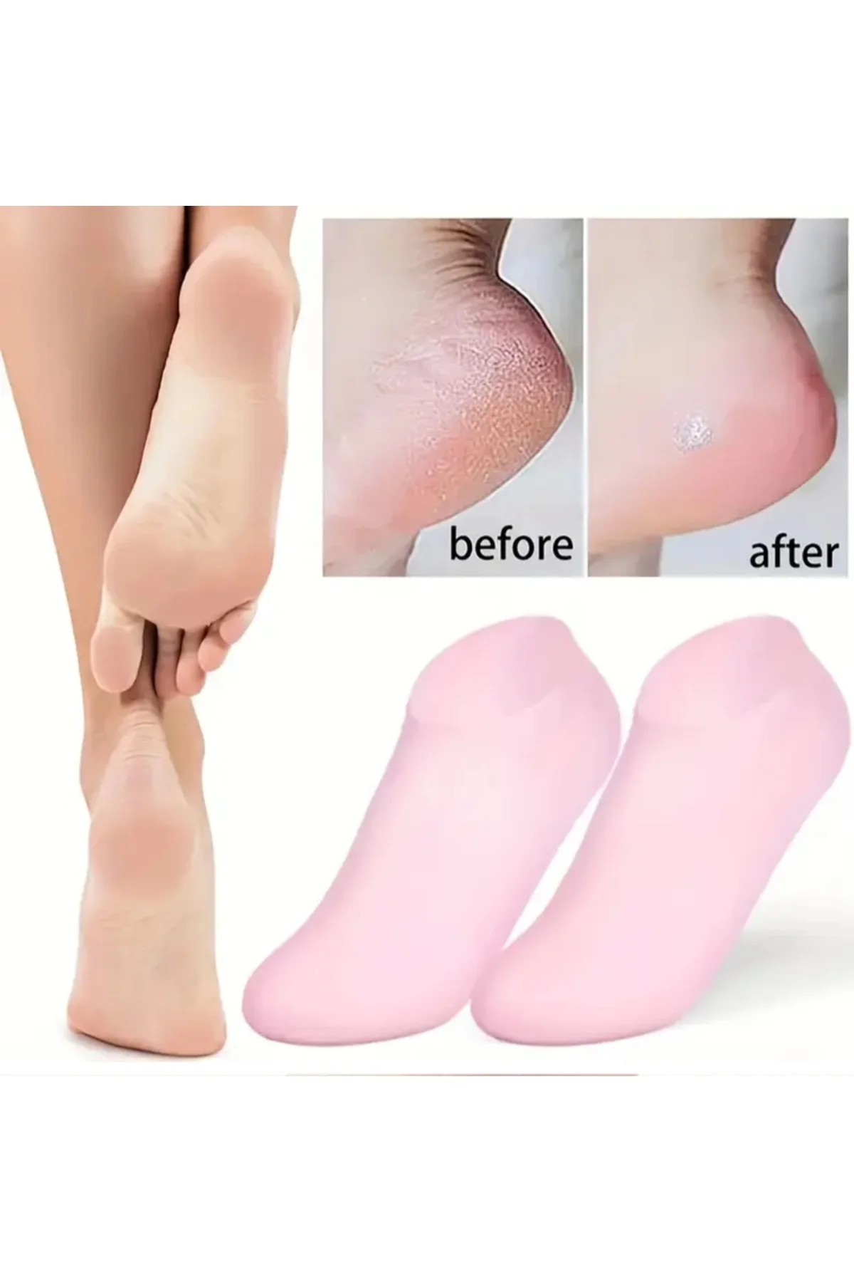 Topuk Çatlağı Giderici Onarıcı Ayak Bakım Çorabı Kuruluk ve Sertl