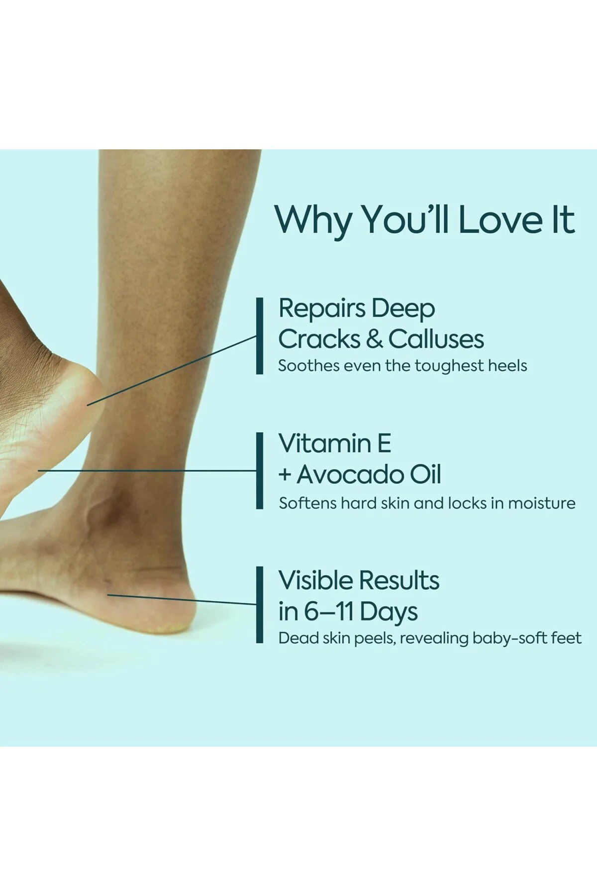 Topuk Çatlağı Kremi – Kuru ve Çatlamış Topuklar için – E Vitamini