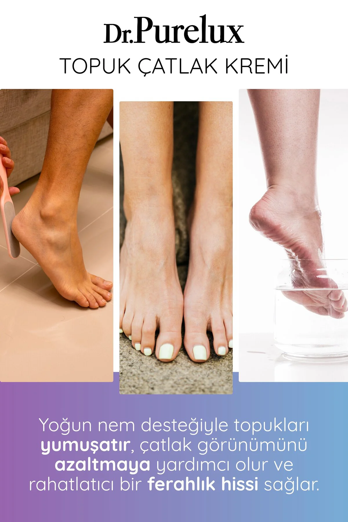 Topuk Çatlak Kremi – Shea Yağı & Hyaluronik Asit İçerikli Yoğun N