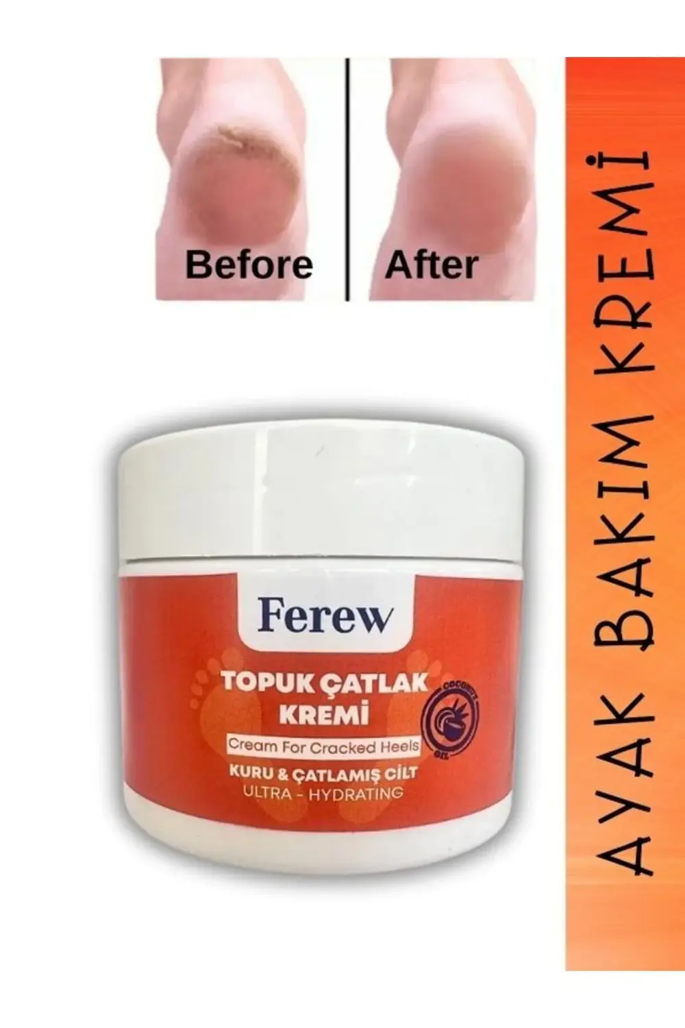 Topuk Çatlak ve Ayak Bakım Kremi 100 ml