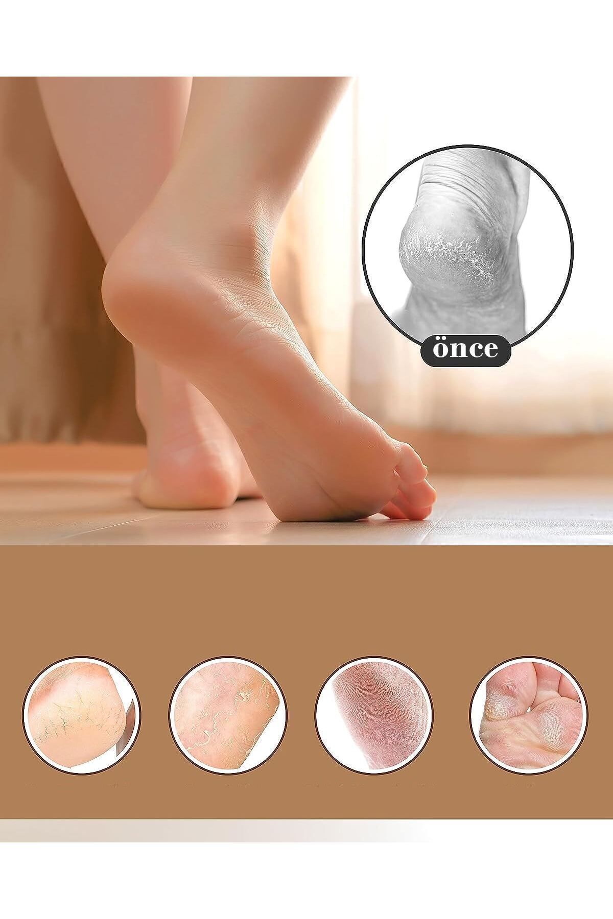 Topuk Törpüsü 2li Set Solingen Professional