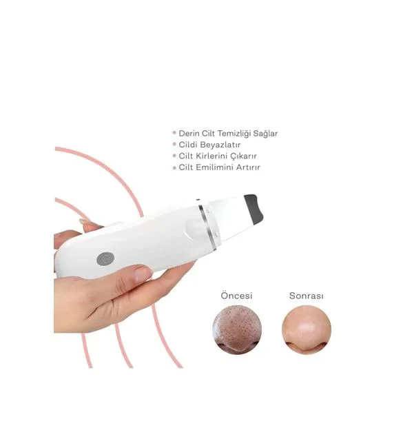 Ultrasonik Spatula — Siyah Nokta Temizleme Cihazı | Akne Giderici Yüz Bakım Ultrasonik Spatula — Siyah Nokta Temizleme Cihazı | Akne Giderici Yüz Bakım