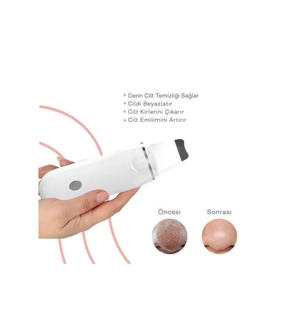 Ultrasonik Spatula Yüz  Siyah Nokta Temizleme