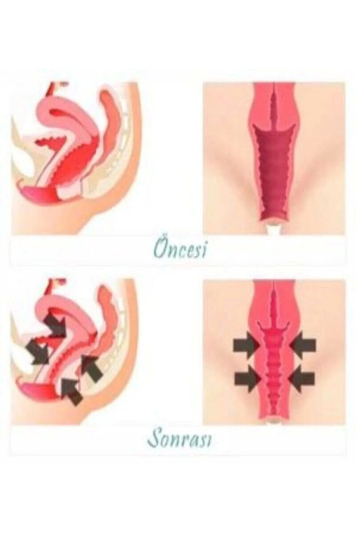 Vagitight Genital Bölge Şekillendirici Krem 100 ml × 3 Adet – Özel Bakım Fiyatı, Yorumları ve Özellikleri